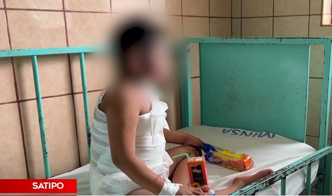 SATIPO: MADRE LANZÓ AGUA CALIENTE A SU HIJO DE 10 AÑOS (VIDEO)