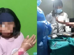 ¡TERRIBLE! MADRE QUEMA EL ANTEBRAZO DE SU HIJA POR TOMAR DINERO SIN SU PERMISO: PADRASTRO FUE COMPLICE