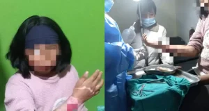 ¡TERRIBLE! MADRE QUEMA EL ANTEBRAZO DE SU HIJA POR TOMAR DINERO SIN SU PERMISO: PADRASTRO FUE COMPLICE