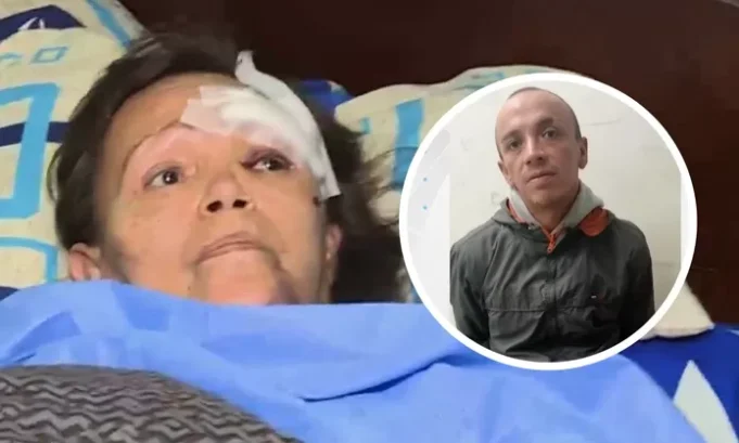 HOMBRE ATACÓ A SU MADRE CON UN BALÓN DE GAS EN EL CALLAO.